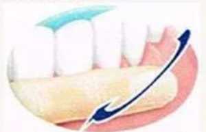 Blog 武蔵小杉の歯医者 歯科 関原デンタルクリニック 武蔵小杉駅30秒